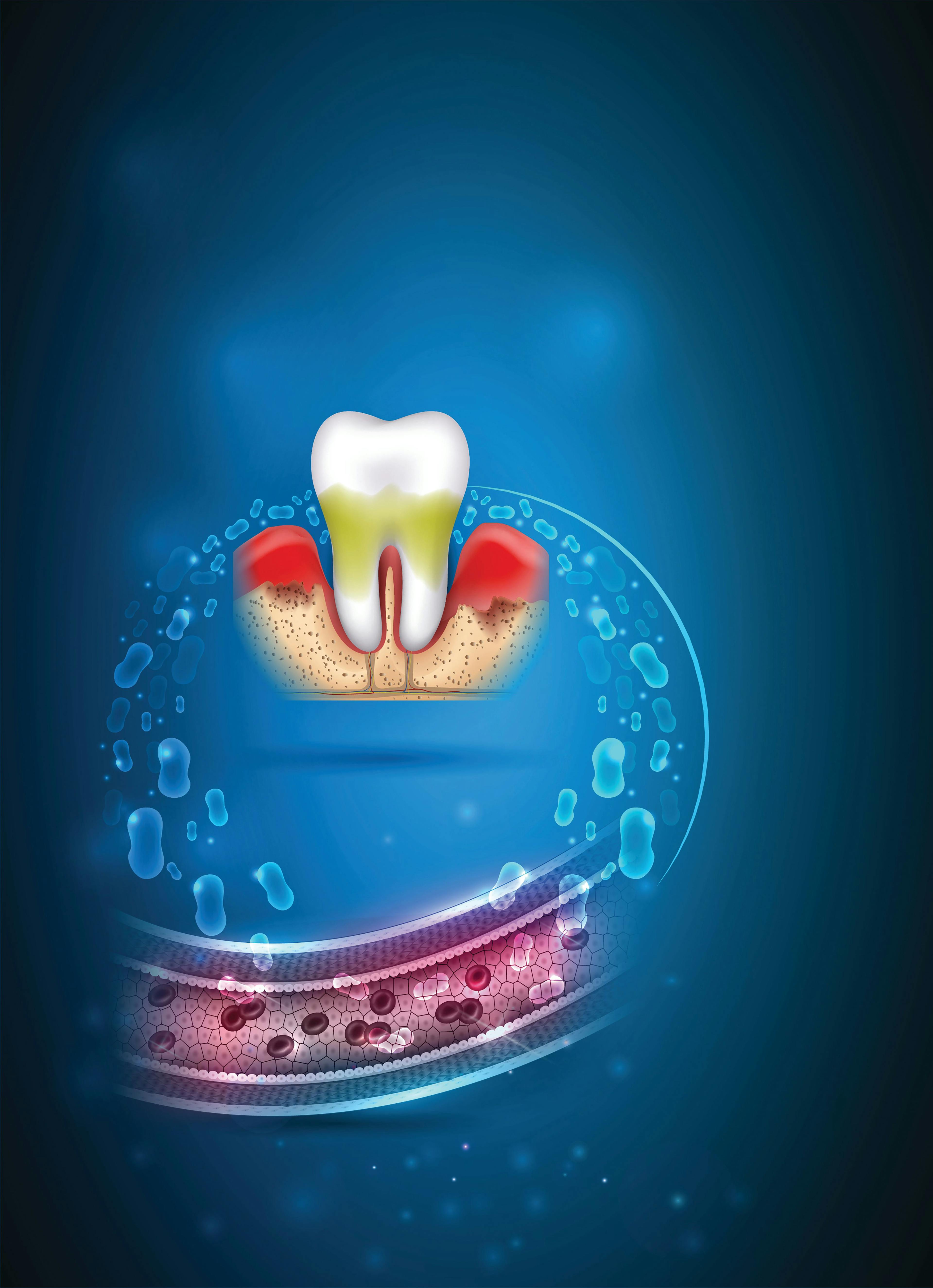 How to Get Patients to Understand the Oral-Systemic Link. Photo courtesy of reineg/stock.adobe.com. 
